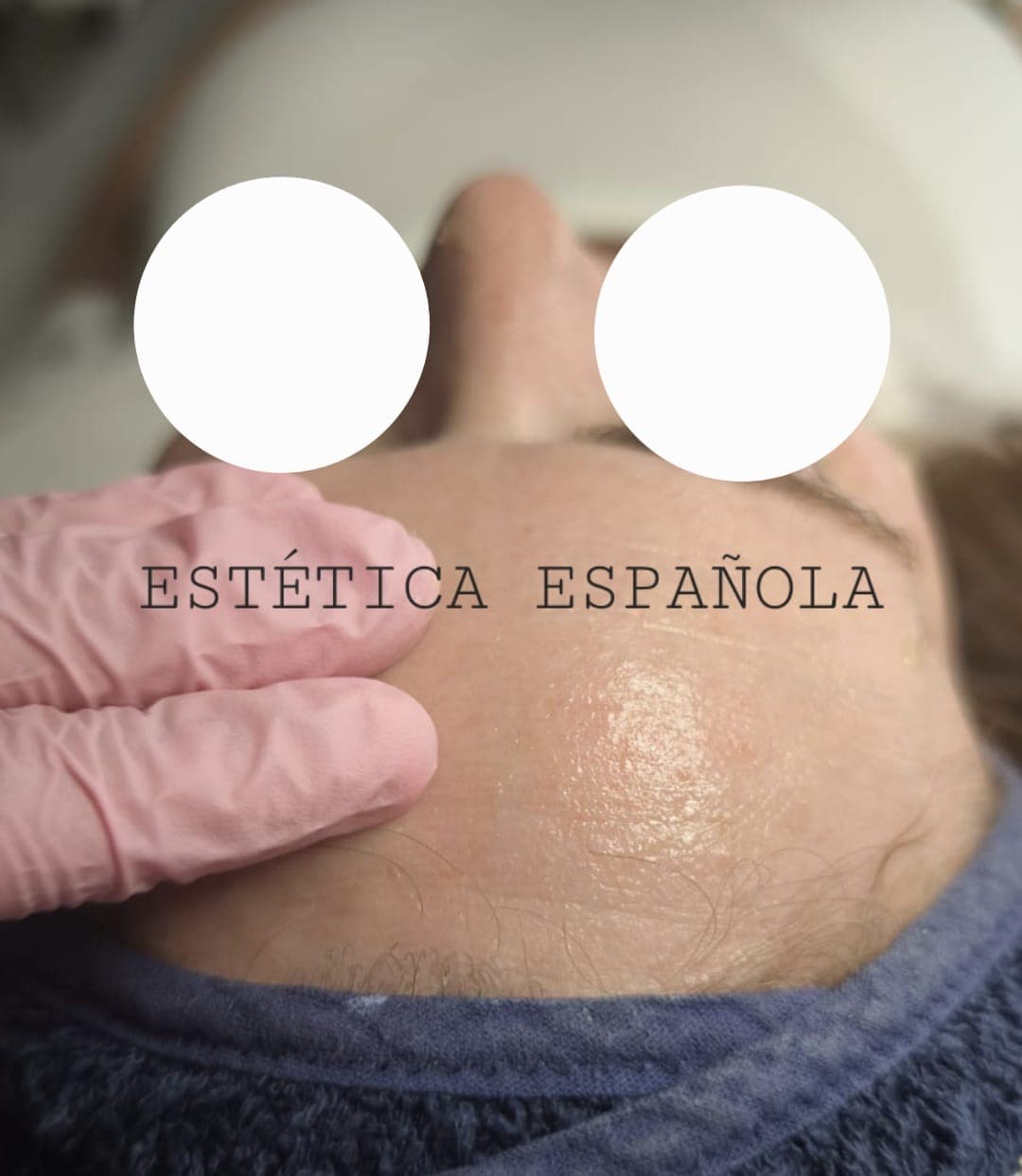 Limpieza Facial — Estética Española
